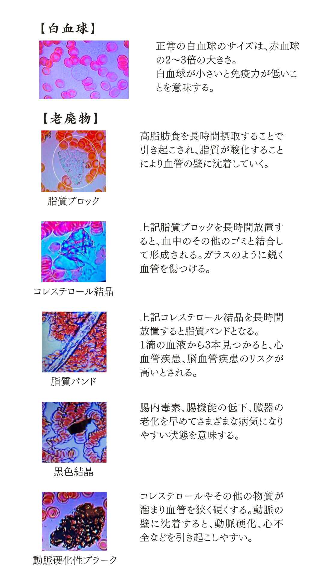 血液観察資料 3ページ：白血球と老廃物
